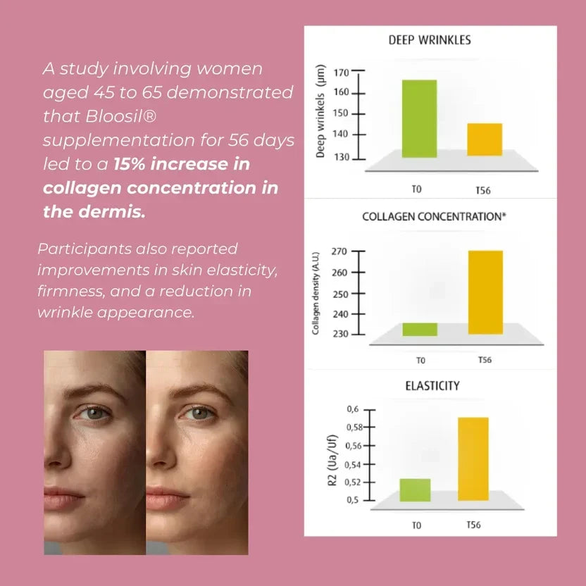 Silica Supplement (Bloosil)
